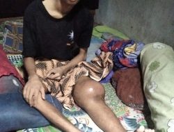 Pihak SMA Negeri 1 Kota Agung Tanggamus Berikan Bantuan ke Pelajar Penderita Kanker